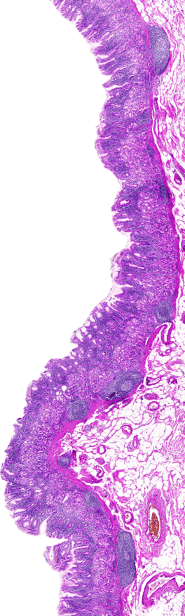 Histology slide image showing a pick and purple tissue