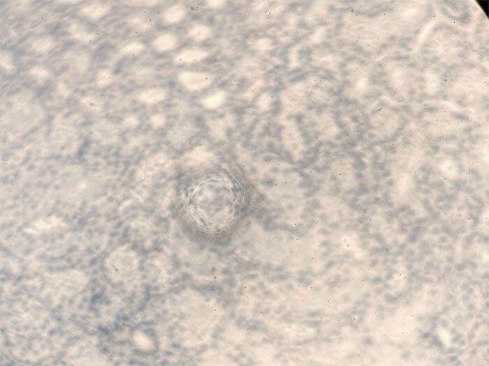 Why your h&e slides are cloudy & how to correct it