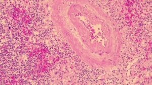 Eosin Y, 1% Alcoholic